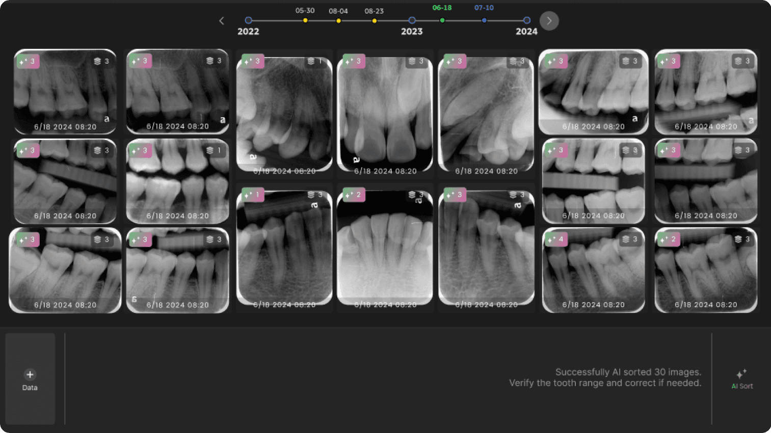 Periapical film set Image