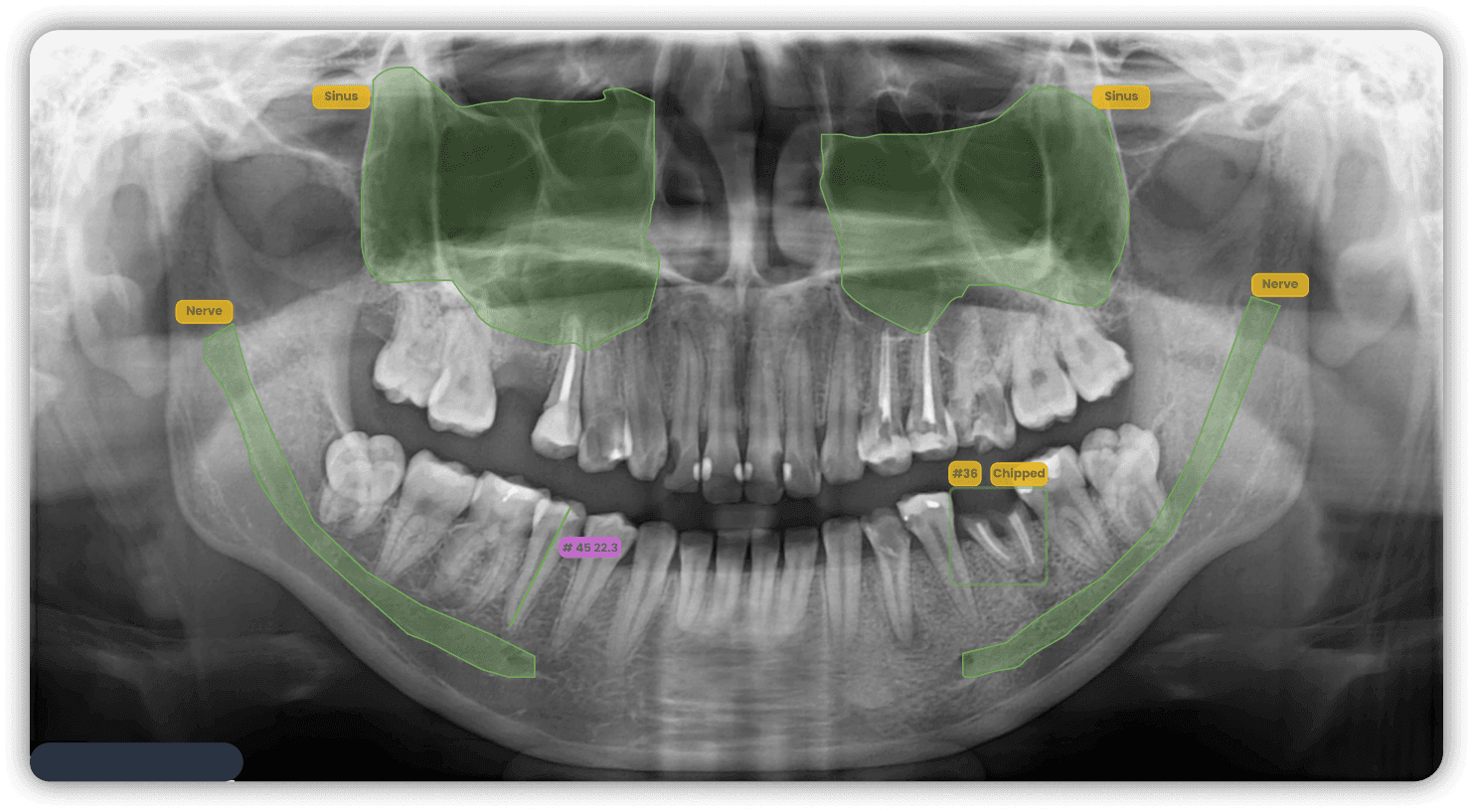 Basic oral diagnostic image