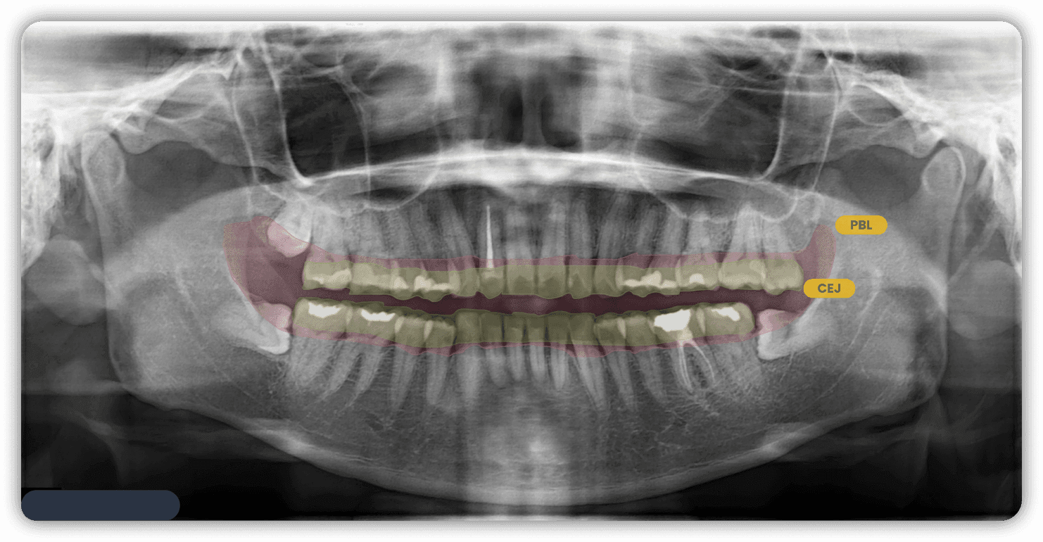 Basic oral diagnostic image